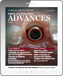 Implantology Advances Ebook Library Image